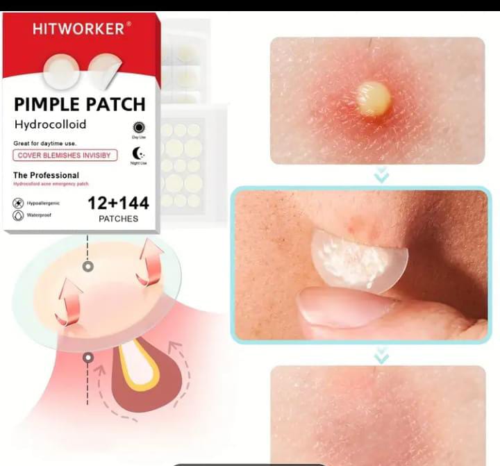 Hydrocolloid Pimple Patch